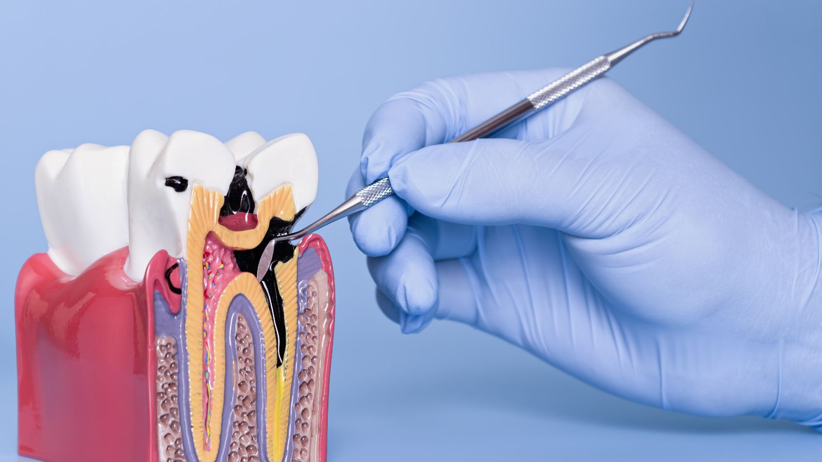 teeth replacement options in Pittsburgh